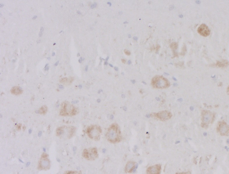 抗ChT(SLC5A7)抗体を用いた免疫染色像